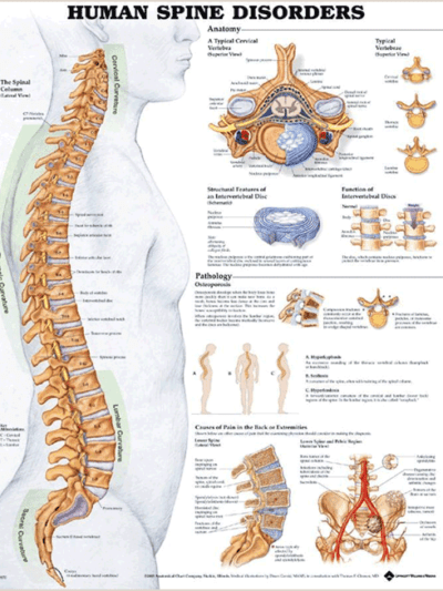 Human Spine Disorders Chart