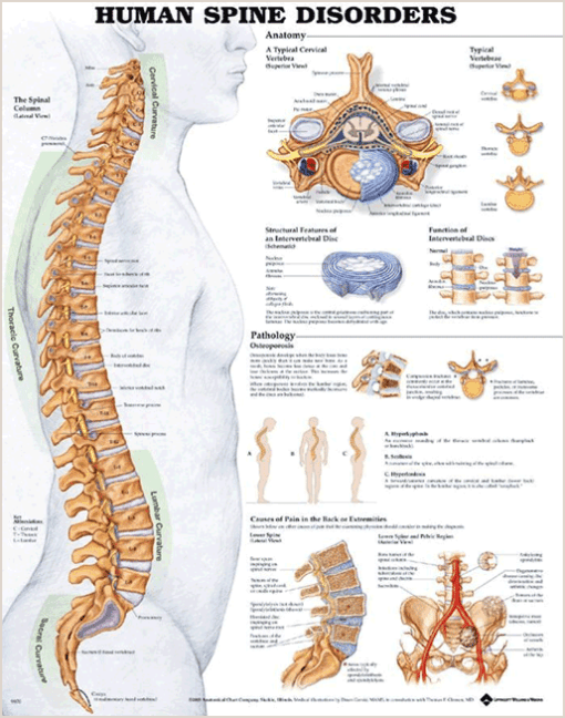 Human Spine Disorders Chart